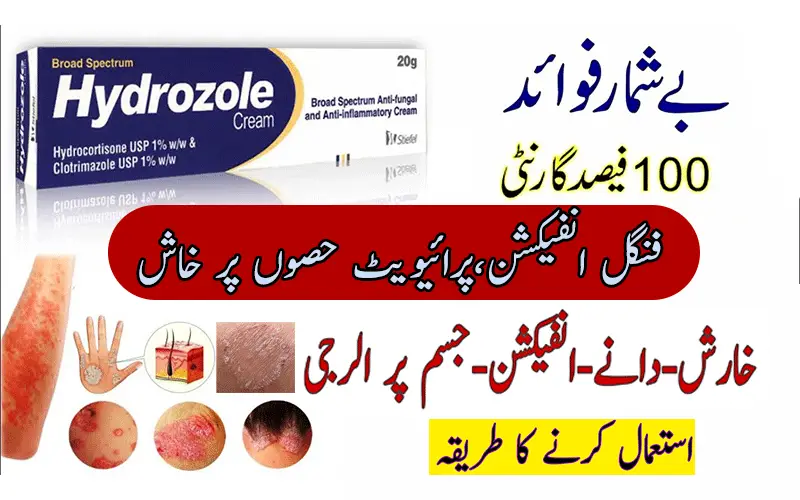 Best Antifungal Hydrozole Cream Uses in Urdu