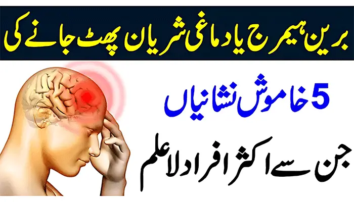 Brain Stroke Symptoms in Urdu: فالج Falij Attack Dimag Ki Nas Phatna ki Nishani