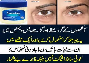 Dark Circle Eye Cream: Dark Circle Khatam Karne Ka Tarika In Urdu