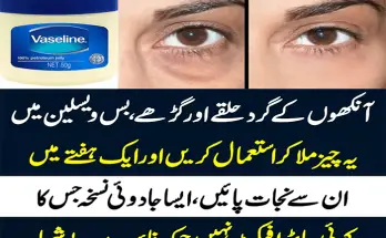 Dark Circle Eye Cream: Dark Circle Khatam Karne Ka Tarika in Urdu