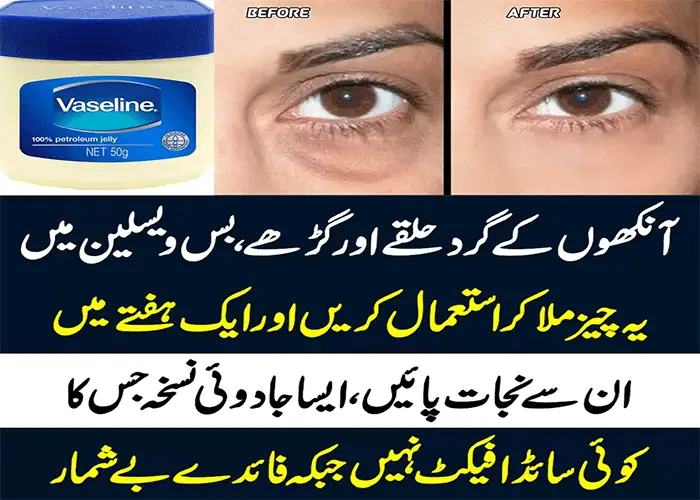 Dark Circle Eye Cream: Dark Circle Khatam Karne Ka Tarika in Urdu