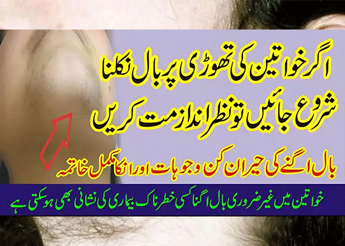 Unwanted Hair Growth in Urdu how to Stop Hair Growth on Face Permanently