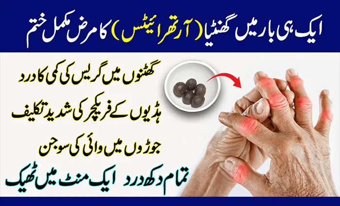 6 Natural Home Remedies For Rheumatoid Arthritis Pain