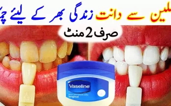  Why Teeth Turn Yellow and How to Get Whiten Teeth with Home Remedies