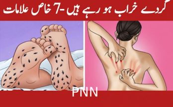 Angioplasty and Stent